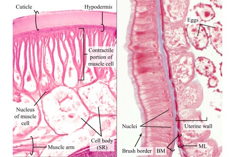 helminthiasis széles galandféreg